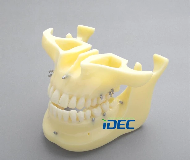 Зубные модели Ортодонтические Мини Винт демонстрация зубы модель имплантата M2016