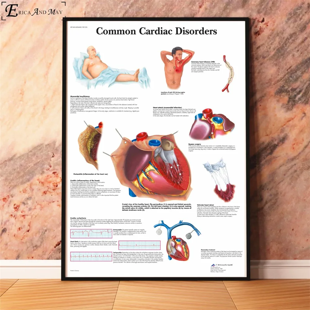 Анатомия болезни патологии диаграмма картина, печатный плакат декоративные настенные картины для комнаты без рамки украшения дома аксессуары