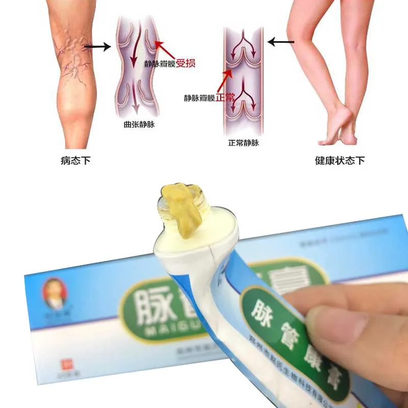 

2pcs Veins Varicose Treatment Plaster Varicose Veins Cure Patch Vasculitis Natural Solution Herbal Patches Veins treatment