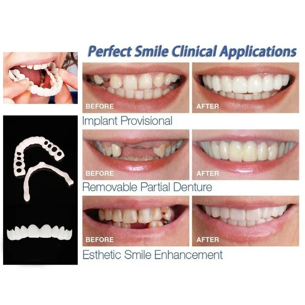 УЛЫБКА протез подходит топ косметические зубы удобный чехол мгновенный комфорт отбеливание зубов протез