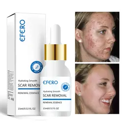 EFERO лицо сыворотка анти старение поры гиалуроновая кислота маска для лица отбеливающий уход за кожей крем для лица с эфирными маслами 15 мл