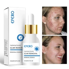 EFERO Face Serum Anti Aging Shrink Pores Hyaluronic Acid Oil Control Moisturizing Whitening Skin Care Essence Face Cream 15ml