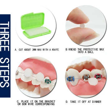 

New Dental Orthodontics Braces Gum Protection Wax 3 Flavor Choice Teeth Whitening Dental Oral care Wax perfect smile veneers