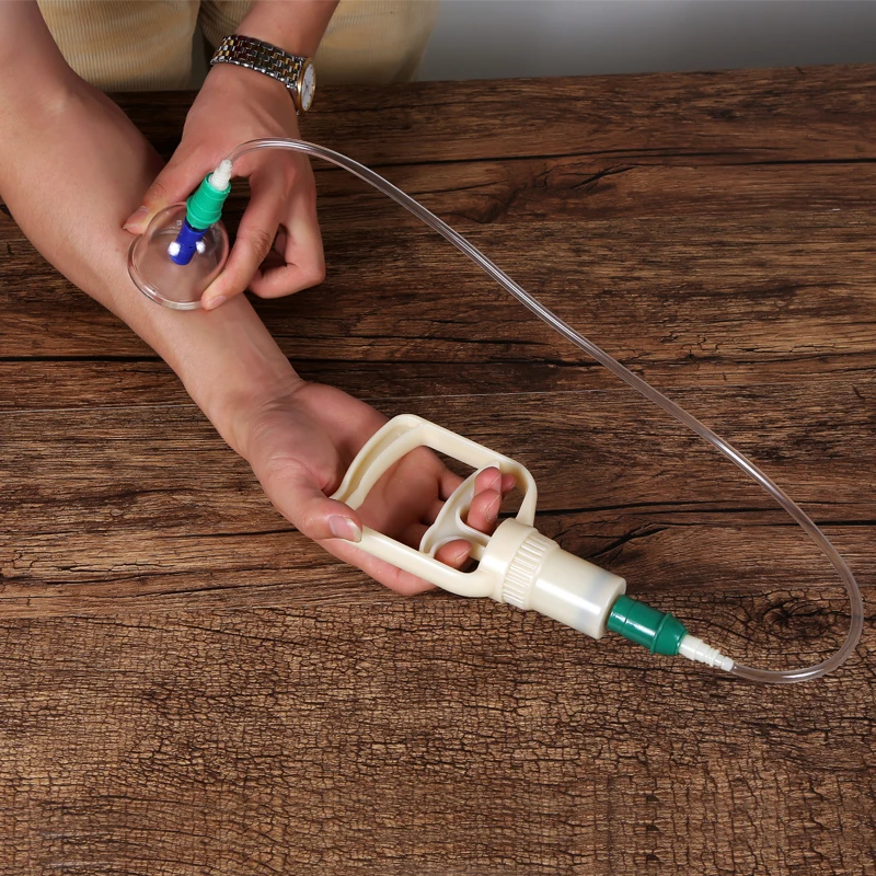 vacuum cupping (8)