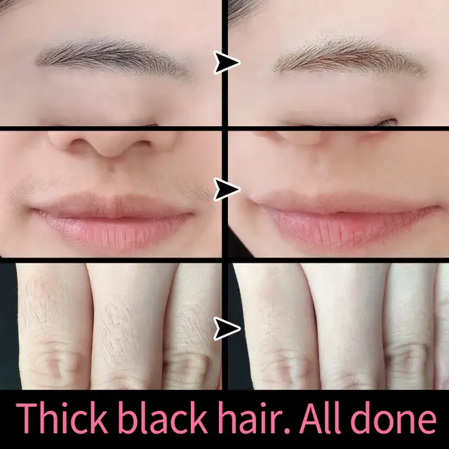 Shvyog Upper Lip Hair Remove Cream Mustache Painless Depilatory