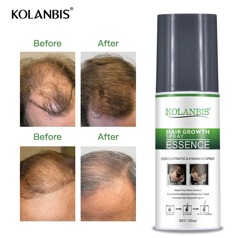 Thick Fast Hair Growth Serum Permanent Alopecia Fuller Hair Growth