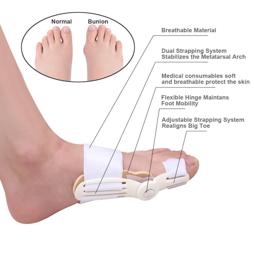 

Big Toe Bunion Splint Straightener Relief Foot Pain Corrector Hallux Valgus Aid Toe Treatment Flexible Hinged Splint