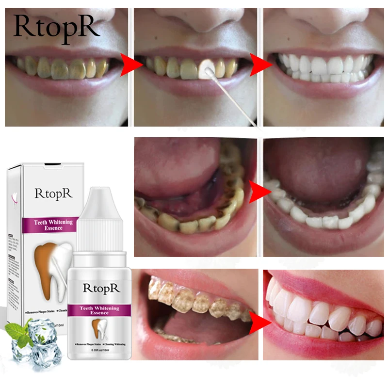 10 мл отбеливающая эссенция для зубов, гигиена полости рта, эссенция, эффективное удаление налета, пятна, чистящее средство, ежедневное использование, чистящая вода для зубов