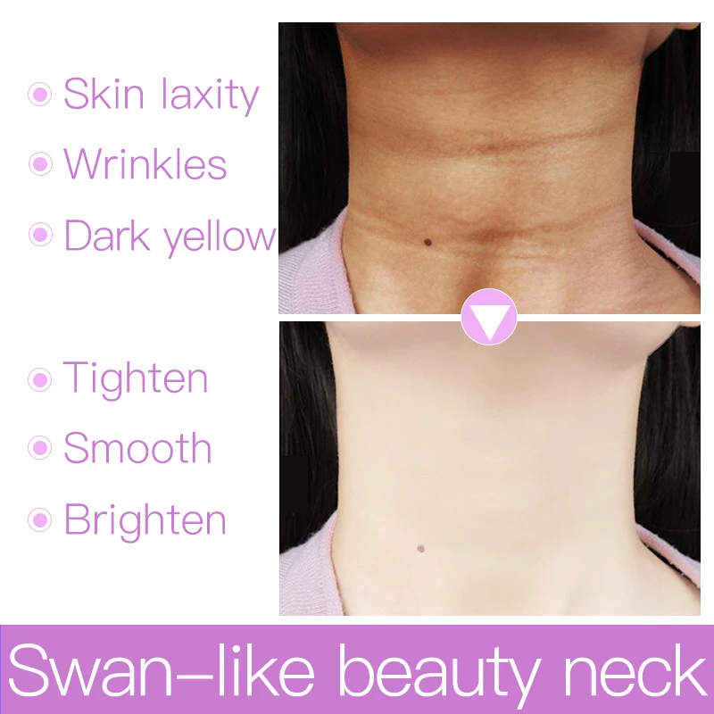 neck black remove cream