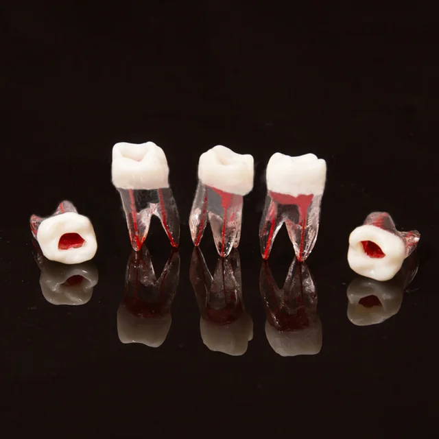 1Pcs Dental Tooth model Root Canal RCT Practice Pulp Cavity Clear Resin