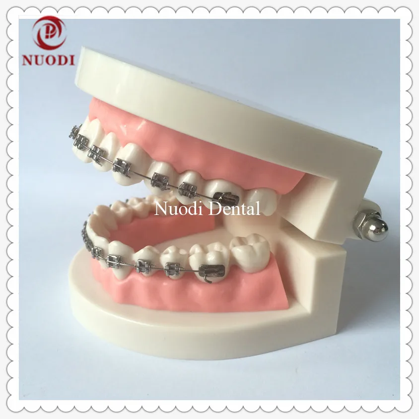 Orthodontic teeth model-3