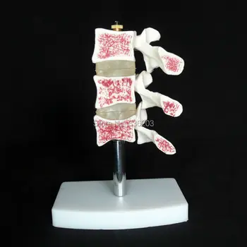 

Human anatomy skeleton Osteoporosis Anatomical Vertebrae disease Model Heart skull brain skull in trauma nursing manikin train