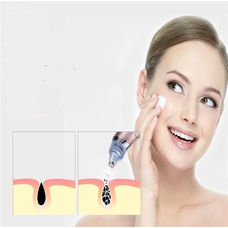 Electric Vacuum Suction Facial Pore Cleaner Nose Blackhead Comedo Remover Face Cleansing Pustule Acne Cleaning Removal Skin Care