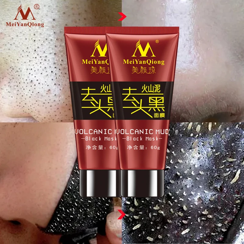 MEIYANQIONG2pcs/lot гамамелиса вулканическая Грязевая Маска глубокое очищение и Отшелушивающий черный голый лица Черный маска уход