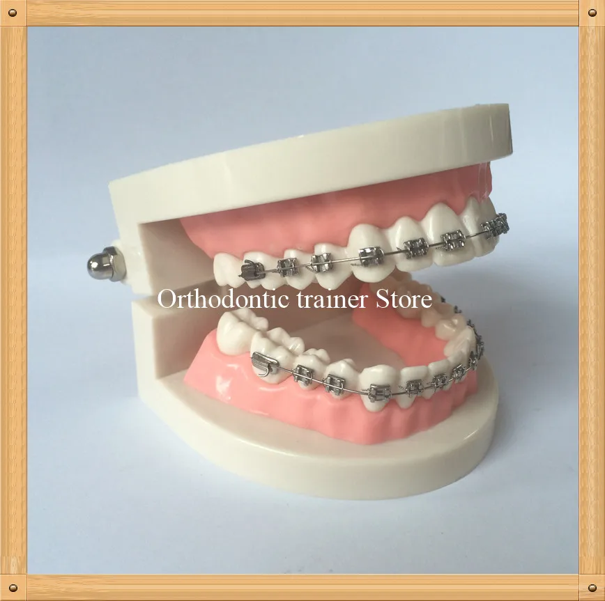 Orthodontic teeth model-4