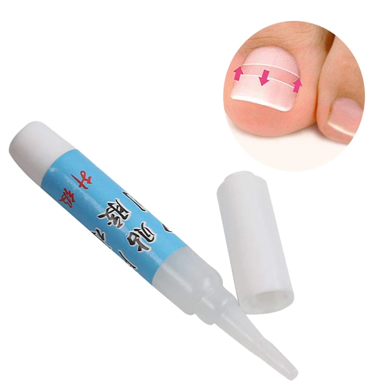 

Nail Glue Ingrown Toenail Correction Pedicure Toe Patch Adhesive Foot Care Tool Manicure Nail Art Decorations Nail Tools