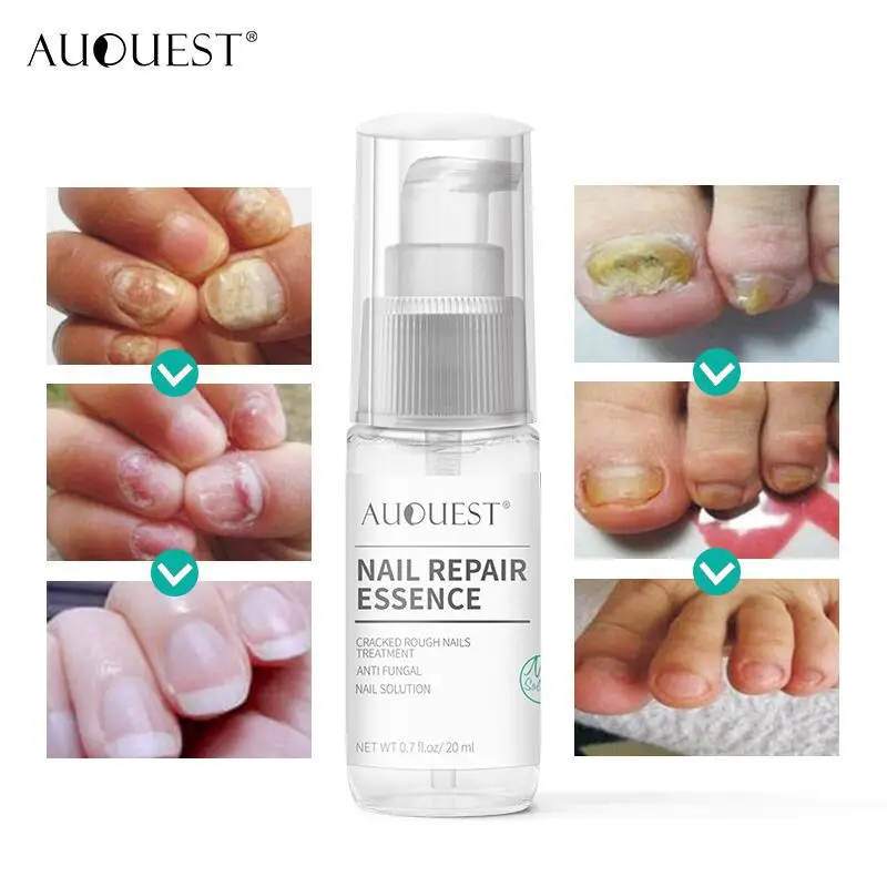 

Professional Nail Repair Essence Crack Repair Antifungal Nail Toenail Bed Treatment Essence Repair Fluid Foot Nail Care TSLM1