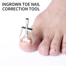 Ingrowning ногти педикюр корректор вросших ногтей ног инструмент коррекции одометра