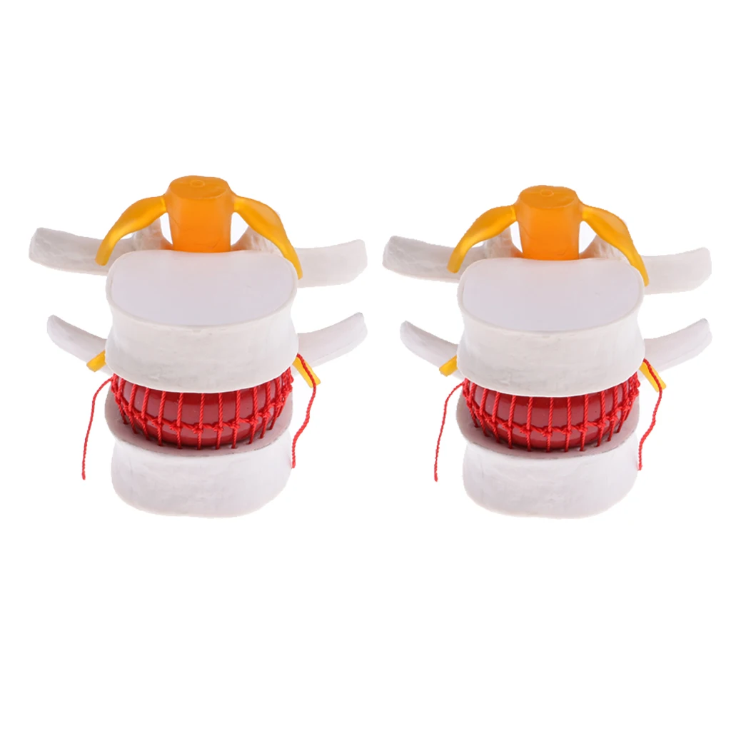 2PCS Magnify 2 Times Human Spine Lumbar Vertebrae Degenerative Disc Skeleton Model Educative Science Toy Lab Study Kits