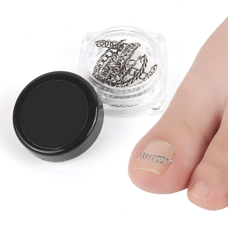 12pcs/box Stainless Steel Wire Paronychia Toe Orthodontic Ingrown Toenail  Correction Pedicure Onychocryptosis Nail Care Tools|Nail Treatments| -  AliExpress