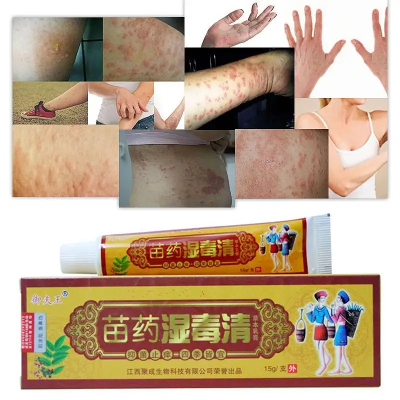 

Body Psoriasis Cream Ointment with Retail Box Skin Care Chinese Ointment Cream For All Kinds Of Skin Problems Plaster