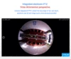 Video Surveillance