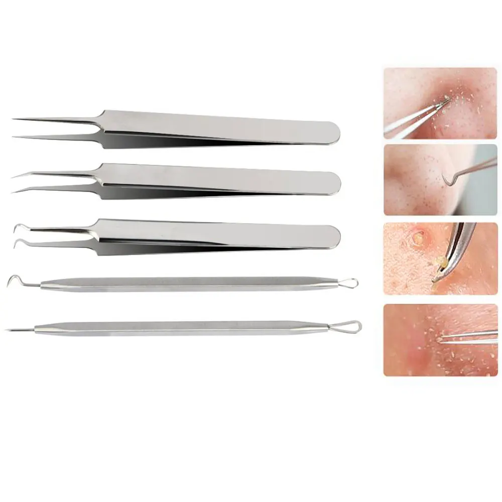 5pcs set Blackhead Pimple Remover Tweezer Blackhead And Comedone Acne Extractor Pore Cleanser Acne Needle Kit