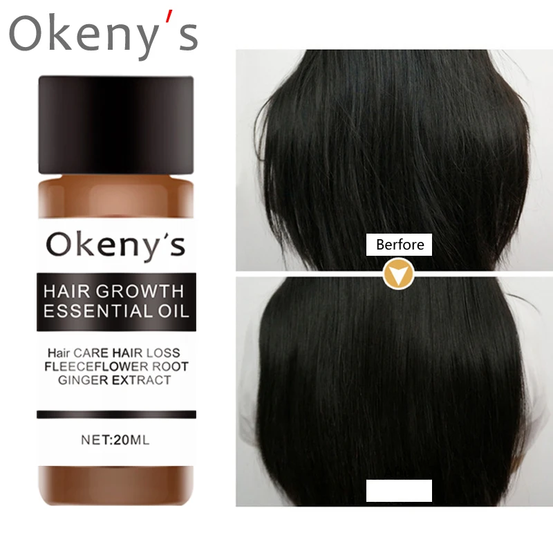 

Fast Hair Growth oil Essence serum ginger shampoo for Women man anti Hair Loss treatment Hair Repair Growing ,Repair Coarse