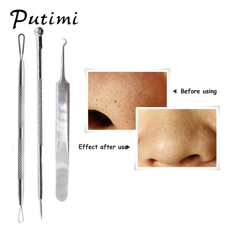 

Putimi 3Pcs Pimple Acne Remover Tool Set Blemish Blackhead Needle Tweezers Comedone Extractor Pore Cleansing for Face Skin Care