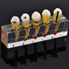 Endodontic pathological model pathology Patient communication model Endodontic treatment Posterior Teeth Dental Pulp Restoration ► Photo 1/6
