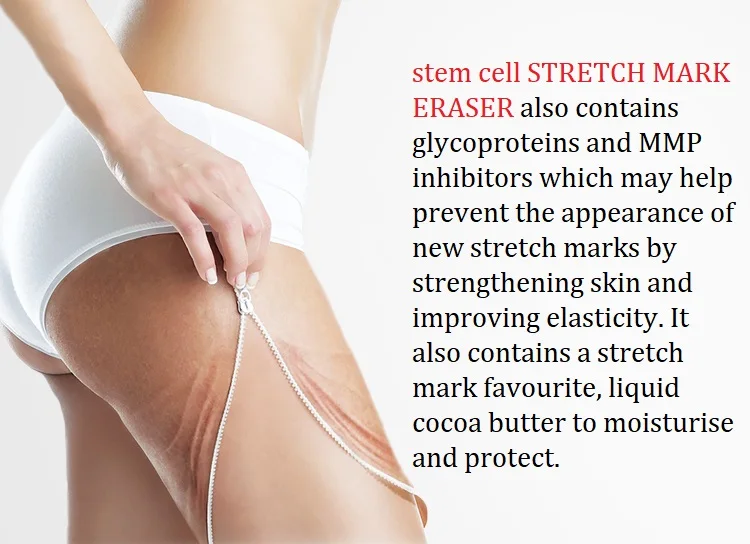 Австралия Freezeframe стволовых клеток лечение для упрямый старый новый стрейч MARK ластик поврежденной кожи улучшить эластичность гладкой кожи