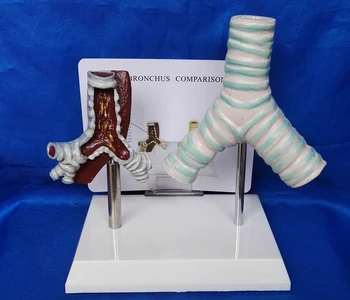 

Smoking Trachea and Normal Trachea Comparison Model Human Trachea Smoking Pathology VS Normal Model Medical Teaching Model