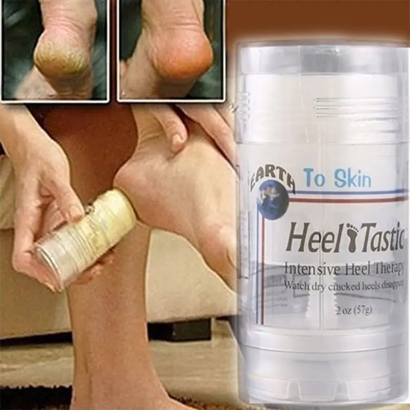 

Foot Heel Nourish Anti Fungal Dry Crack Repair Anti-Drying Frostbite Cream Dead Skin Remover Skin Care
