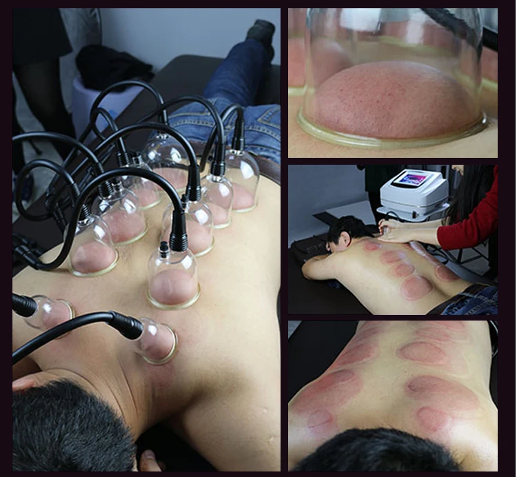 Breast Enlargement Body shaping Vacuum Massage Therapy With Breast Enlargement Cellulite Removal Machine For Salon Use 3