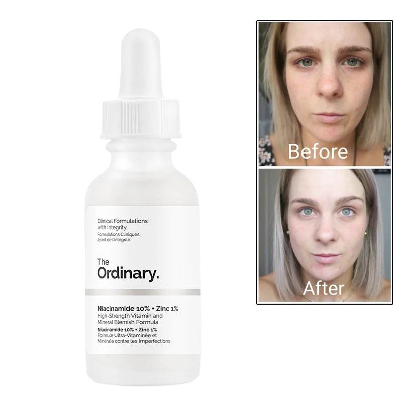

30ml Ordinary Niacinamide 10% + Zinc 1% 30ML Face Serum Oil Balance Reduce Skin Blemishes Whitening Moisturizer