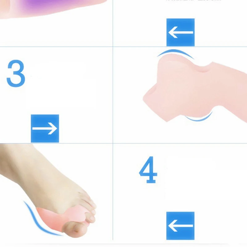 2Pcs Silicone Gel Toe Separator Metatarsal Bunion Splint Protection Corrector Orthotics Hallux Valgus Pain Relief Foot Care Tool