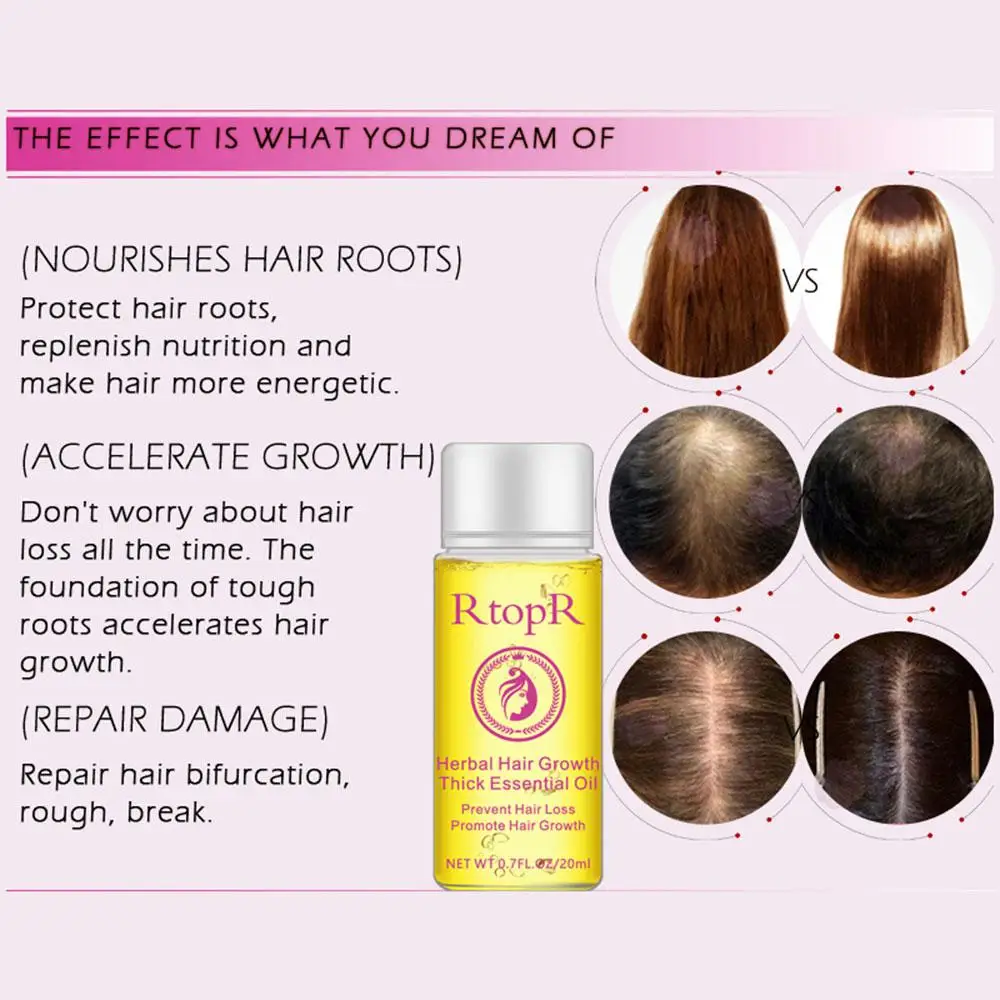 20ml Hair Oil Fast Hair Growth Essence Human Baldness Natural