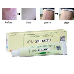 20 шт Zudaifu крем для ухода за кожей крем от псориаза дерматит экзематоид экзема мазь лечение крем от псориаза