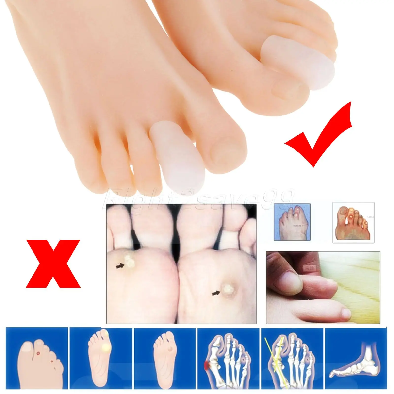 

New 1 Pair Toe Cushions Toe Protector Caps Protector Silicone Gel Toe Caps Hammer Claw Blisters Corns Pain Relief