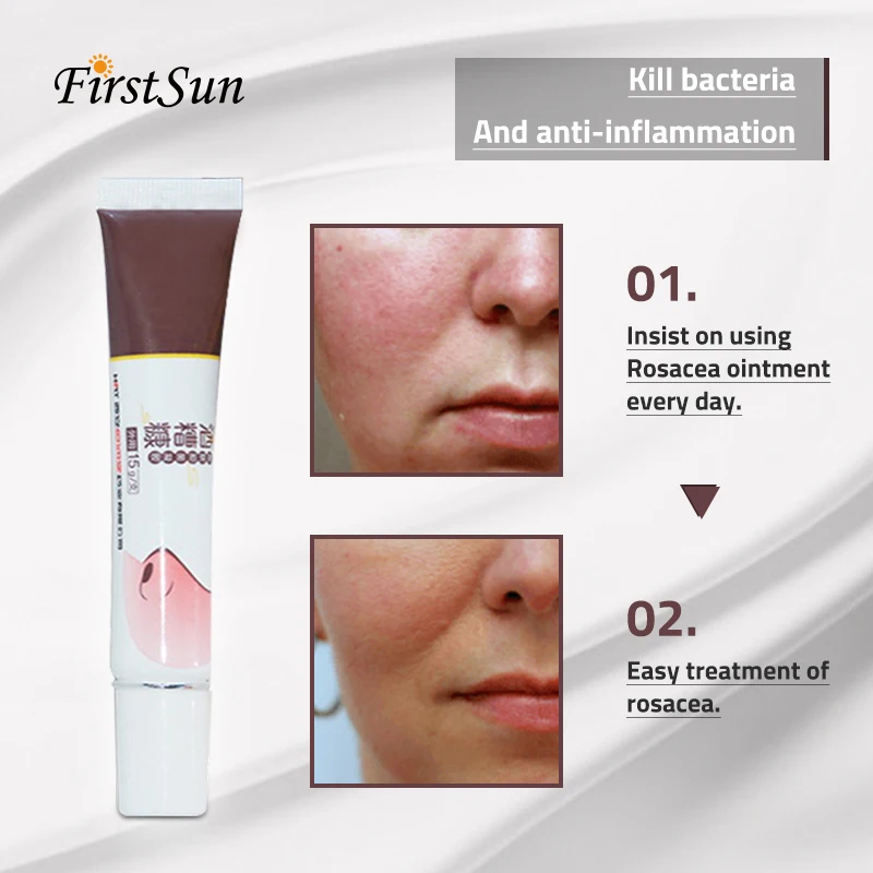 Firstsun Cremas Para La Rosacea травяные растения лекарство лечение красный нос удаление черных точек акне клещей крем уход за кожей сужение пор