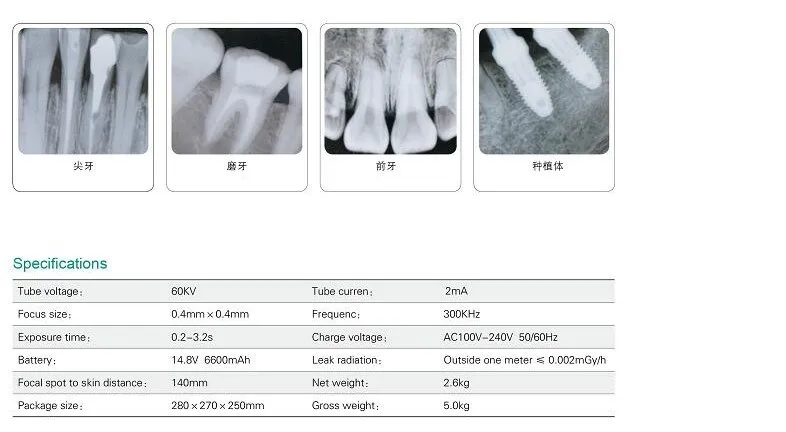 Стоматологическая портативная рентгеновская установка/высокочастотная портативная стоматологическая рентгеновская машина/стоматологическая система визуализации портативная рентгеновская машина