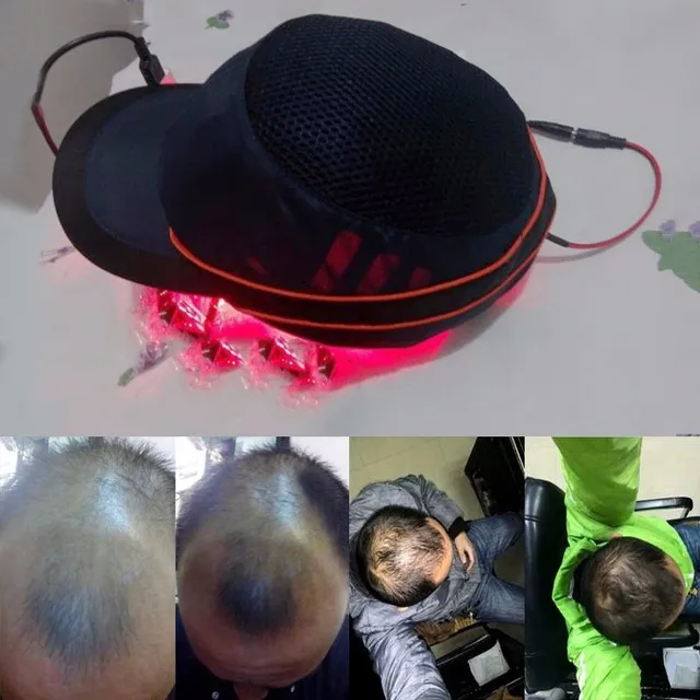Advanced Laser Hair Growth Cap