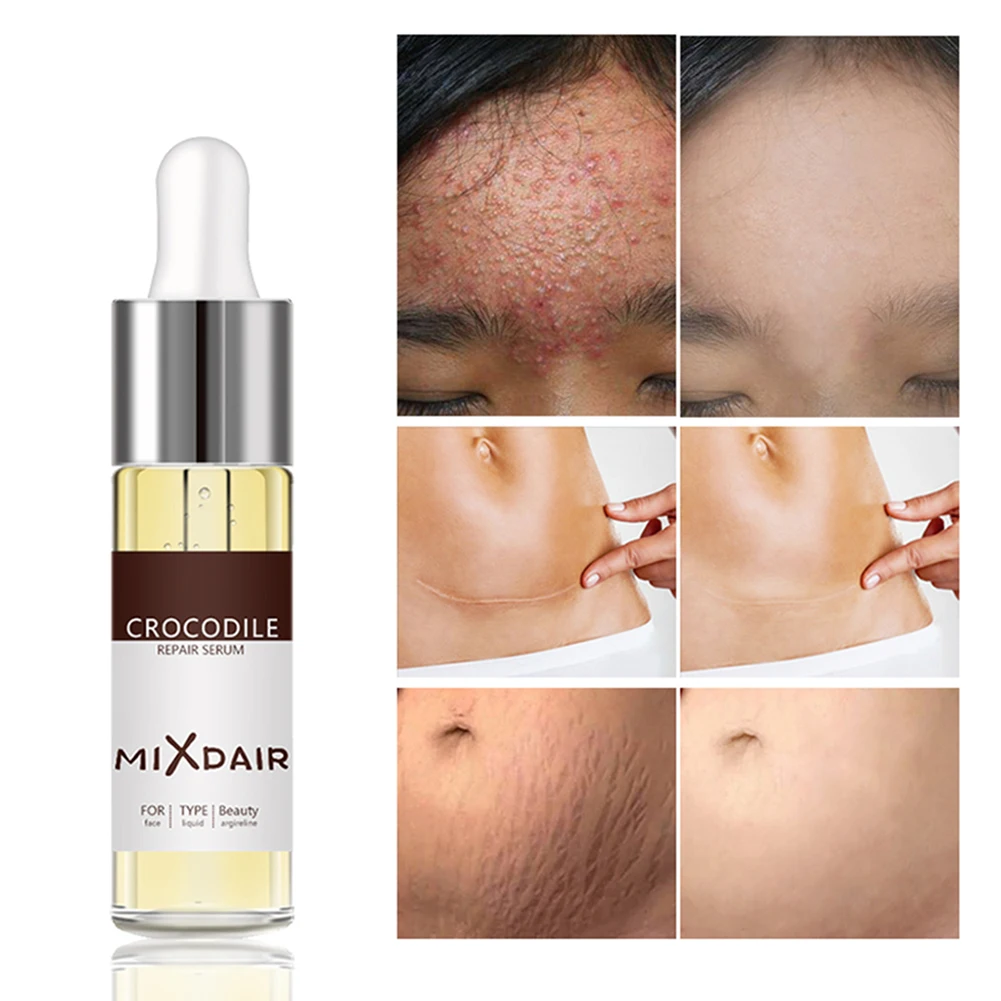 face serum for textured skin