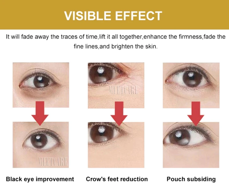 Hyaluronic-Acid-Pen-detail-1-(3)