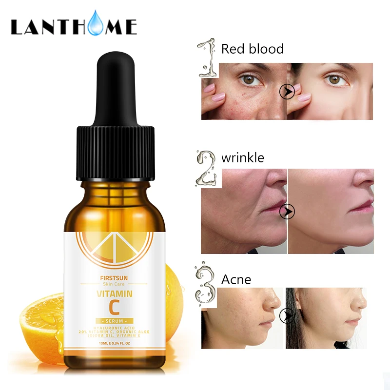 

Lanthome Ultra Brightening Spotless Oil Dark Spots Remover Face Whitening Serum Organic Face Moisturizer Oil Skin Care Anti Acne