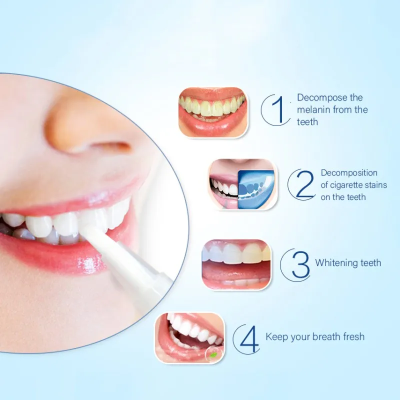 Отбеливающая ручка пероксид гель Белый Зуб Чистка отбеливание стоматологический набор пятновыводитель гигиена полости рта
