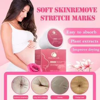

Stretch Mark Body Cream Lighten Prevent Stretch Marks Postpartum Repair Cream Moisturizer Body Cream