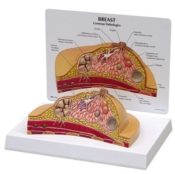 

breast anatomical model Breast lesions breast pathology model Training model