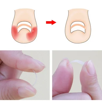 

Ingrown Correction Sticker Patch Foot Care Paronychia Correction File Elastic Patch Corrector Treatment Tools 10pcs/box Toe Nail