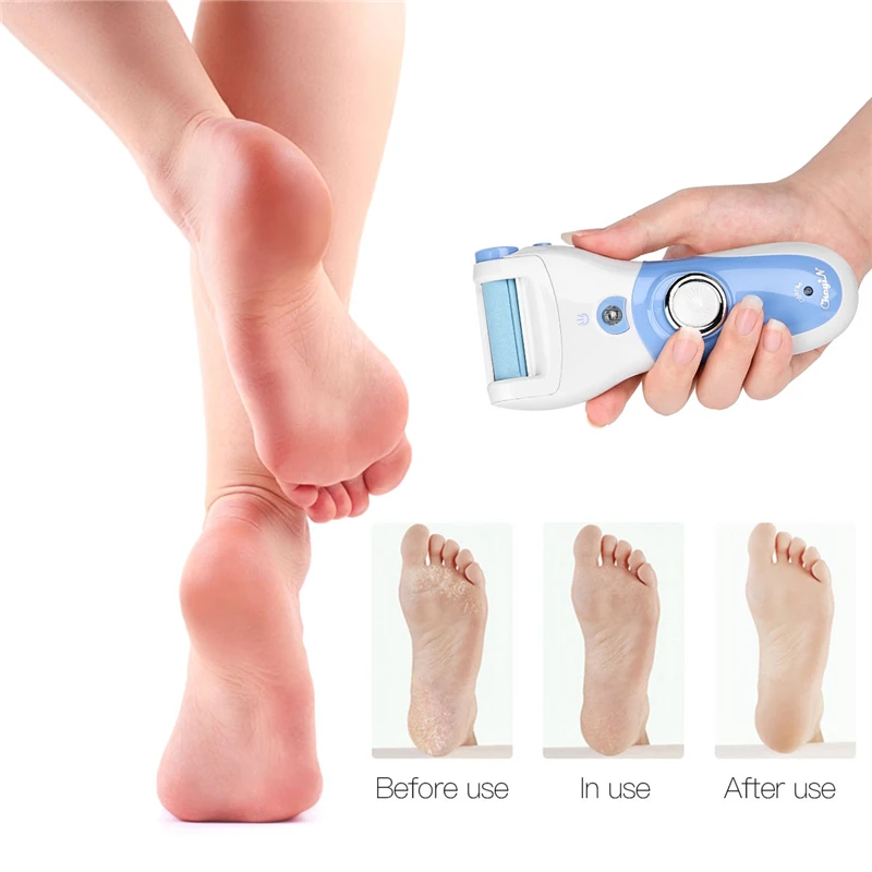 Electric Foot Care Tool Dead Skin Remover Feet Exfoliator Heel Grinding Pedicure Feet File Callus Remove Rough Fine Roller Head